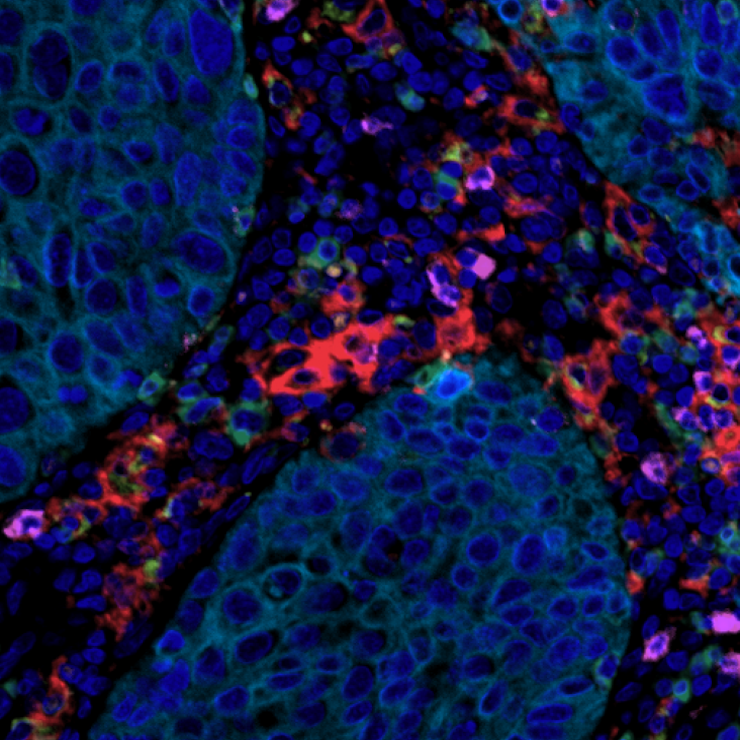 Zoomed image of multiplex tissue