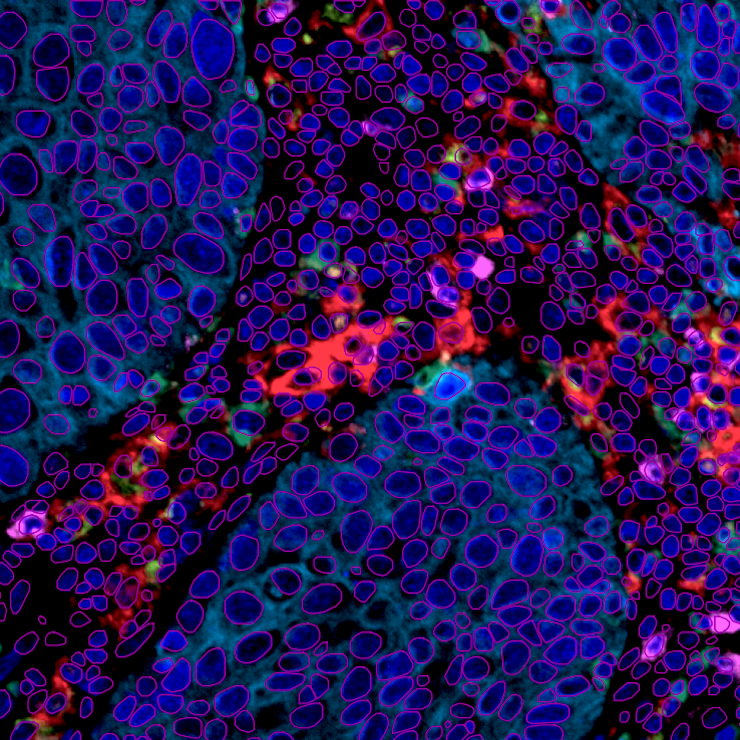 Zoomed image of multiplex tissue with nuclei segmentation