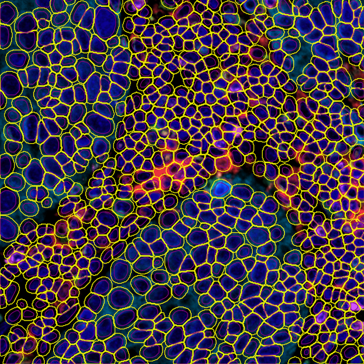 Zoomed image of multiplex tissue with cell and nuclei segmentation