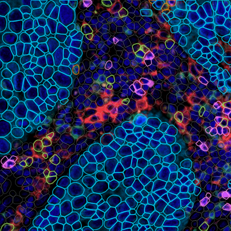 Zoomed image of multiplex tissue with cell classification