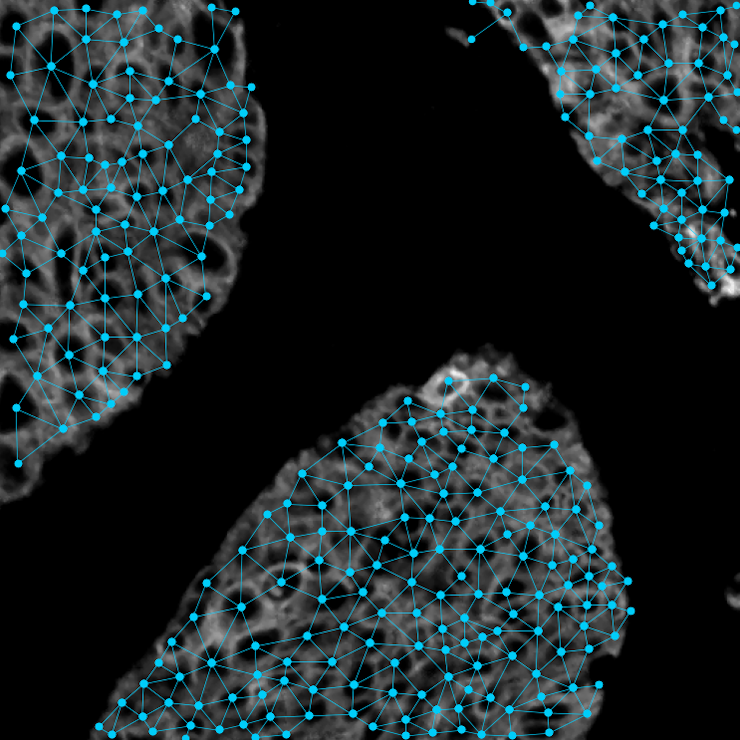 Zoomed image of multiplex tissue of neighbours graph structures